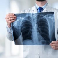 XRay